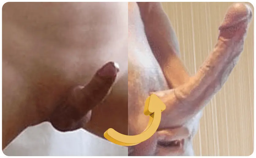 depoimento antes e depois